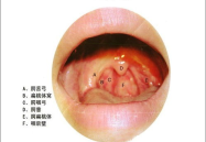 喉炎症状,喉炎症状全面解析